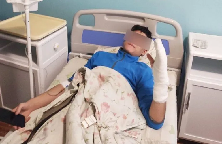 В Новых Санжарах жестоко избили подростка: полиция расследует инцидент